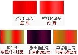 便血