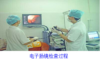 电子肠镜检查过程