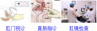 肛门检查方法